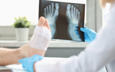 Should I Go to Urgent Care for an X-Ray?